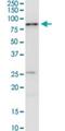 Interleukin 1 Receptor Associated Kinase 3 antibody, H00011213-M07, Novus Biologicals, Western Blot image 