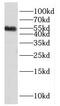HNRPK antibody, FNab03955, FineTest, Western Blot image 