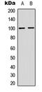 Nuclear Factor Kappa B Subunit 2 antibody, MBS829066, MyBioSource, Western Blot image 