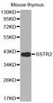 Somatostatin Receptor 2 antibody, LS-C332379, Lifespan Biosciences, Western Blot image 
