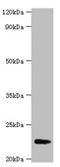 Fibroblast Growth Factor 21 antibody, CSB-PA06404A0Rb, Cusabio, Western Blot image 