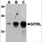 TNF Superfamily Member 18 antibody, 3591, ProSci, Western Blot image 