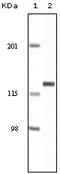 EPH Receptor A2 antibody, STJ98024, St John