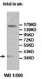 Acyl-CoA Synthetase Family Member 3 antibody, orb77472, Biorbyt, Western Blot image 