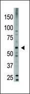 Bone morphogenetic protein 6 antibody, 59-003, ProSci, Western Blot image 