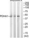 Pyruvate Dehydrogenase E1 Alpha 1 Subunit antibody, abx014766, Abbexa, Western Blot image 