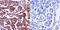 HRas Proto-Oncogene, GTPase antibody, MA1-012X, Invitrogen Antibodies, Immunohistochemistry frozen image 