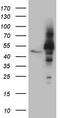 RNA-binding protein NOB1 antibody, LS-C794543, Lifespan Biosciences, Western Blot image 