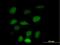 Zinc Finger Protein 157 antibody, H00007712-B01P, Novus Biologicals, Immunofluorescence image 
