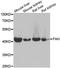Ectonucleoside Triphosphate Diphosphohydrolase 2 antibody, A07914, Boster Biological Technology, Western Blot image 
