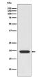 CD3d Molecule antibody, M04405, Boster Biological Technology, Western Blot image 