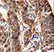 Aldehyde Dehydrogenase 3 Family Member A1 antibody, LS-C97466, Lifespan Biosciences, Immunohistochemistry paraffin image 