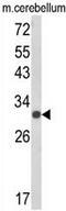 Upstream Transcription Factor 2, C-Fos Interacting antibody, GTX81158, GeneTex, Western Blot image 