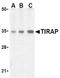 TIR Domain Containing Adaptor Protein antibody, AP05226PU-N, Origene, Western Blot image 