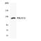 Phosphatidylinositol-4,5-Bisphosphate 3-Kinase Catalytic Subunit Gamma antibody, LS-C200488, Lifespan Biosciences, Western Blot image 