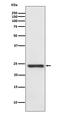Heat Shock Protein Family B (Small) Member 8 antibody, M02492, Boster Biological Technology, Western Blot image 