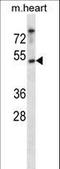 Casein Kinase 1 Epsilon antibody, LS-C164354, Lifespan Biosciences, Western Blot image 