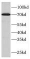 Fem-1 Homolog B antibody, FNab03072, FineTest, Western Blot image 