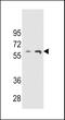 THUMP Domain Containing 3 antibody, 55-444, ProSci, Western Blot image 