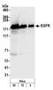 EGFR antibody, A300-388A, Bethyl Labs, Western Blot image 