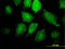 Inhibitor Of Nuclear Factor Kappa B Kinase Regulatory Subunit Gamma antibody, LS-C133550, Lifespan Biosciences, Immunofluorescence image 