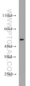 Thyroid Hormone Receptor Alpha antibody, 10139-1-AP, Proteintech Group, Western Blot image 
