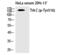 Neurotrophic Receptor Tyrosine Kinase 3 antibody, PA5-40271, Invitrogen Antibodies, Western Blot image 