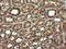 TRNA Methyltransferase 2 Homolog A antibody, NBP2-46015, Novus Biologicals, Immunohistochemistry paraffin image 