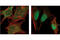 SMAD2 antibody, 3122S, Cell Signaling Technology, Immunofluorescence image 