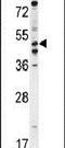 Phosphodiesterase 7B antibody, PA5-24169, Invitrogen Antibodies, Western Blot image 