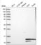 Hemoglobin subunit alpha-1 antibody, NBP2-54711, Novus Biologicals, Western Blot image 