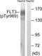 Fms Related Tyrosine Kinase 3 antibody, LS-C198966, Lifespan Biosciences, Western Blot image 
