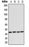 Adenosine A2a Receptor antibody, orb213530, Biorbyt, Western Blot image 