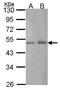 C-Terminal Binding Protein 2 antibody, PA5-30001, Invitrogen Antibodies, Western Blot image 