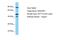 RAS Guanyl Releasing Protein 1 antibody, NBP1-98413, Novus Biologicals, Western Blot image 