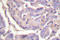 Cbl Proto-Oncogene antibody, LS-C176395, Lifespan Biosciences, Immunohistochemistry paraffin image 