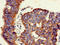 Galactosidase Beta 1 antibody, LS-C678086, Lifespan Biosciences, Immunohistochemistry paraffin image 