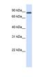 HECT Domain E3 Ubiquitin Protein Ligase 2 antibody, orb330302, Biorbyt, Western Blot image 