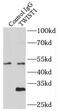 Twist Family BHLH Transcription Factor 1 antibody, FNab09118, FineTest, Immunoprecipitation image 