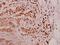 Proteasome 26S Subunit, Non-ATPase 11 antibody, A08940, Boster Biological Technology, Immunohistochemistry paraffin image 