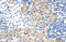 Ribonuclease H2 Subunit A antibody, orb324883, Biorbyt, Immunohistochemistry paraffin image 