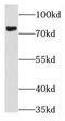 THO Complex 5 antibody, FNab08668, FineTest, Western Blot image 