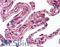 Ire1-alpha antibody, LS-B4154, Lifespan Biosciences, Immunohistochemistry paraffin image 