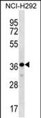 THAP Domain Containing 8 antibody, PA5-48531, Invitrogen Antibodies, Western Blot image 