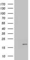 Insulin Like Growth Factor 1 antibody, LS-C339711, Lifespan Biosciences, Western Blot image 