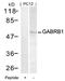 Gamma-Aminobutyric Acid Type A Receptor Beta1 Subunit antibody, 79-582, ProSci, Western Blot image 