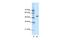 Cholinergic Receptor Nicotinic Alpha 9 Subunit antibody, PA5-46826, Invitrogen Antibodies, Western Blot image 