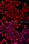 Retinoic Acid Receptor Gamma antibody, 22-948, ProSci, Immunofluorescence image 