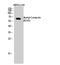 Cortactin antibody, STJ97224, St John