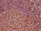 Voltage Dependent Anion Channel 1 antibody, CSB-RA025821A0HU, Cusabio, Immunohistochemistry paraffin image 